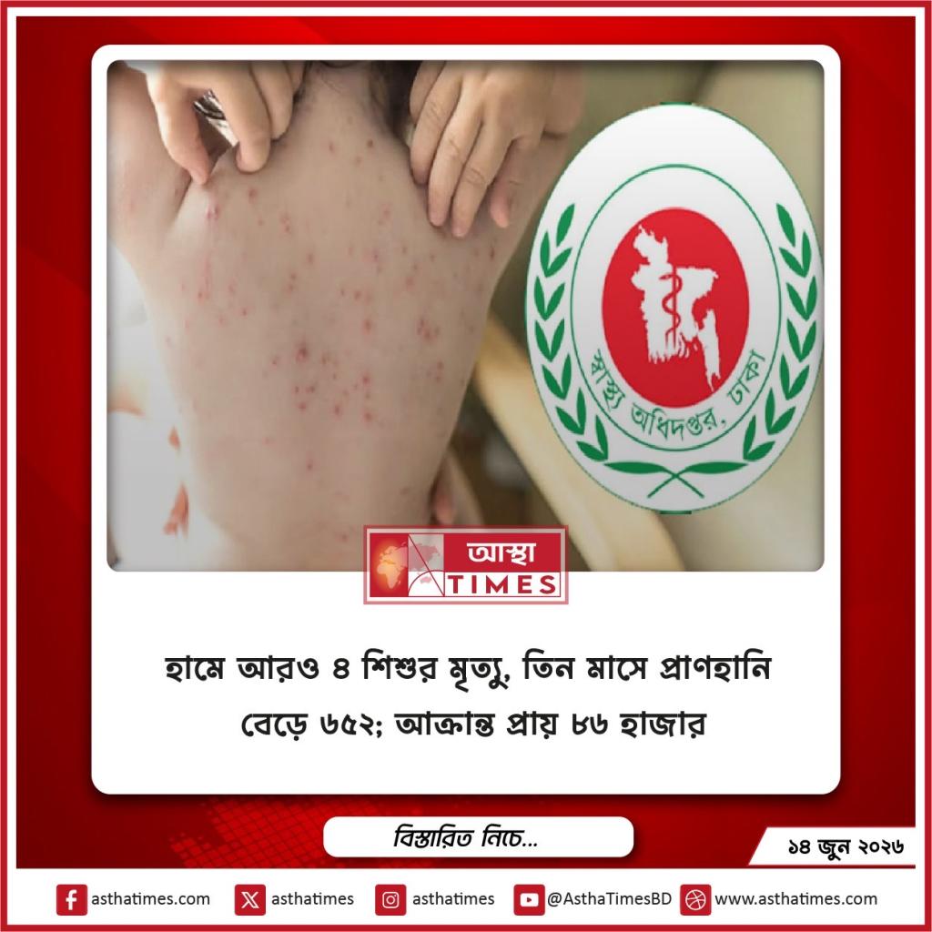 হামে আরও ৪ শিশুর মৃত্যু, তিন মাসে প্রাণহানি বেড়ে ৬৫২; আক্রান্ত প্রায় ৮৬ হাজার