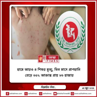 হামে আরও ৪ শিশুর মৃত্যু, তিন মাসে প্রাণহানি বেড়ে ৬৫২; আক্রান্ত প্রায় ৮৬ হাজার