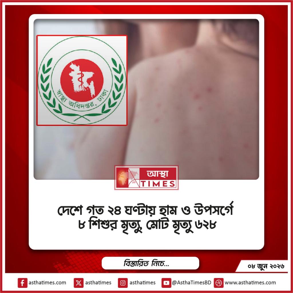 দেশে গত ২৪ ঘণ্টায় হাম ও উপসর্গে ৮ শিশুর মৃত্যু, মোট মৃত্যু ৬২৮